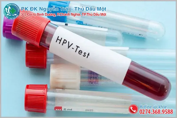 Các phương pháp xét nghiệm HPV hiện nay
