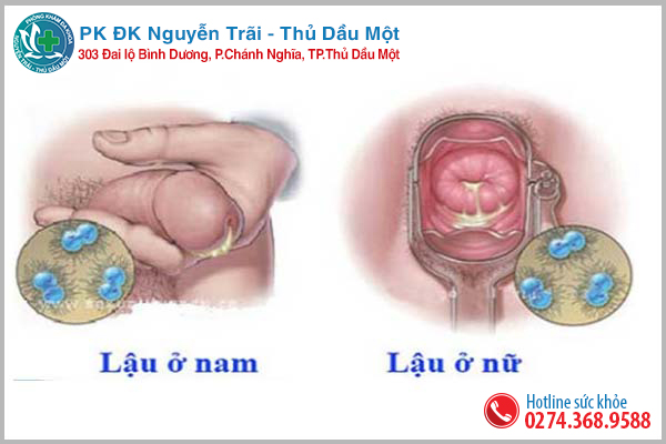 Dấu hiệu bệnh lậu ở nam và nữ giới