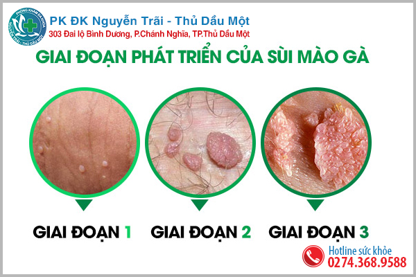 Nổi mụn ở háng – nổi mụn ở bẹn là dấu hiệu của căn bệnh gì?