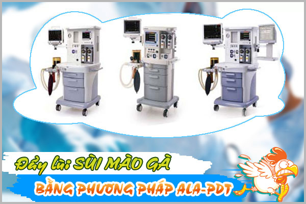 ALA – PDT phương pháp hỗ trợ điều trị sùi mào gà hiệu quả