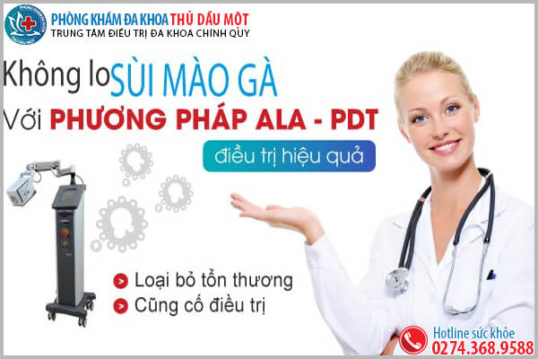 Đốt sùi mào gà