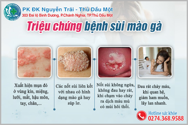 Biểu hiện sùi mào gà ở nam và nữ giới